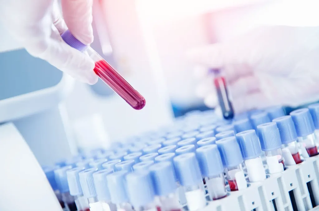 Disease Scanning Service
